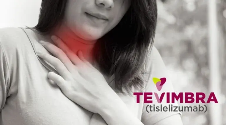 Tevimbra (Tislelizumab-jsgr) Patient Education